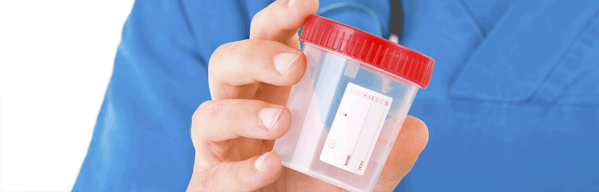 5 Best Practice Tips for Random DOT Drug Testing
