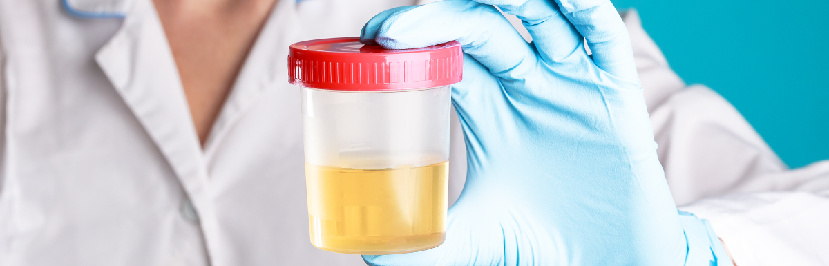 DOT Drug Testing Trends That All Fleet Managers Should Be Aware Of